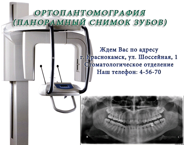 Схема описания ортопантомограммы